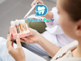 هزینه ایمپلنت یک روزه با جراحی بدون برش لثه