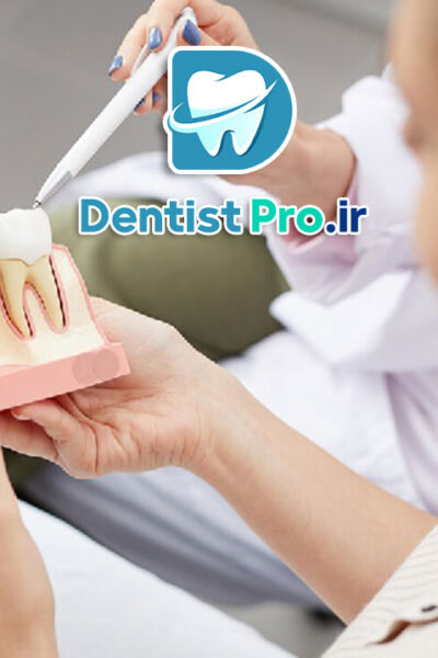 هزینه ایمپلنت یک روزه با جراحی بدون برش لثه