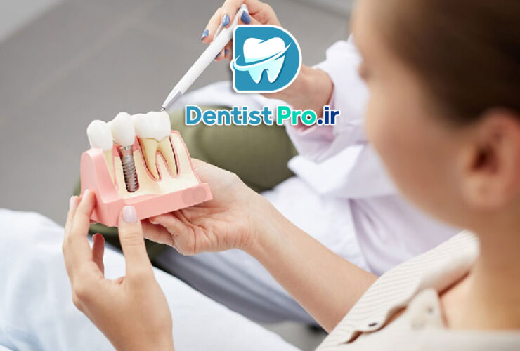 هزینه ایمپلنت یک روزه با جراحی بدون برش لثه 27 هزینه ایمپلنت یک روزه با جراحی بدون برش لثه