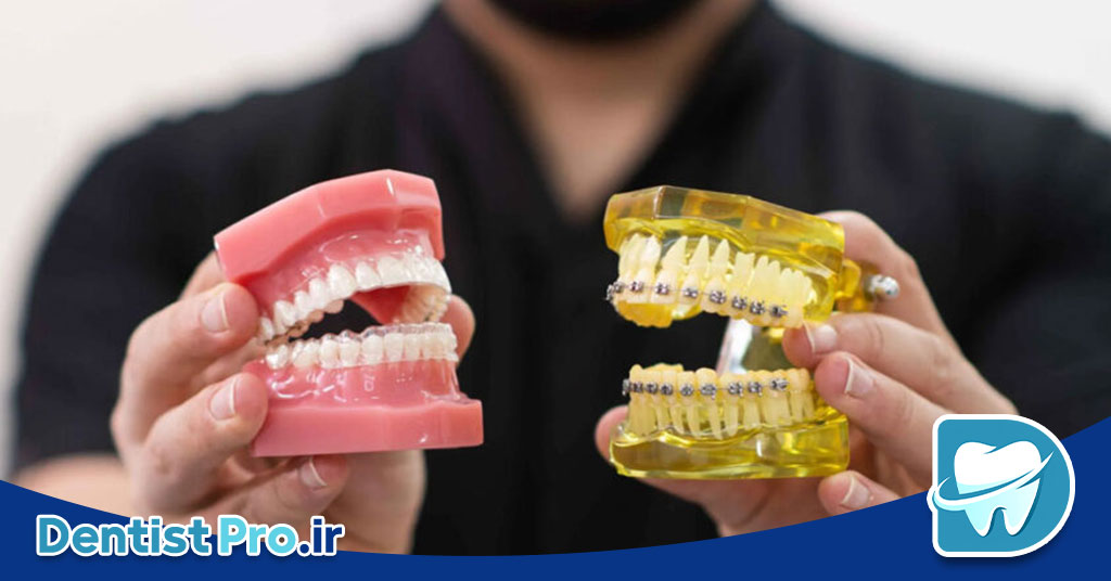 هزینه ارتودنسی نامرئی با کیفیت