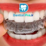 هزینه ارتودنسی نامرئی با کیفیت