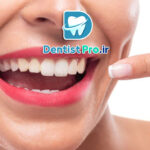 جراحی افزایش طول تاج برای زیبایی لبخند لثه ای