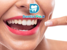 جراحی افزایش طول تاج برای زیبایی لبخند لثه ای