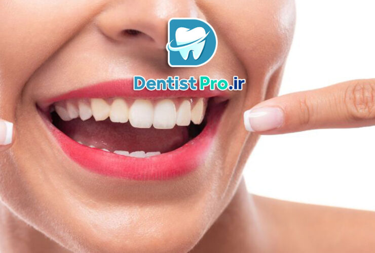 جراحی افزایش طول تاج برای زیبایی لبخند لثه ای 35 جراحی افزایش طول تاج برای زیبایی لبخند لثه ای