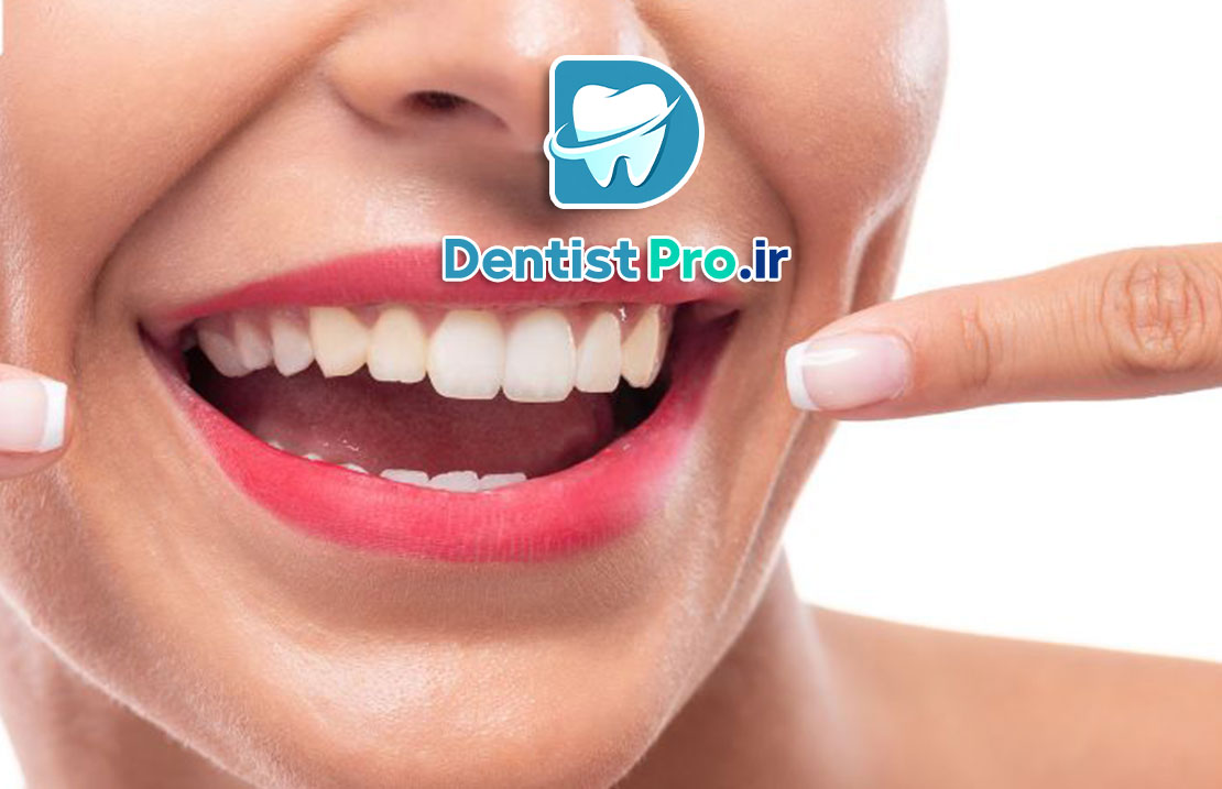 جراحی افزایش طول تاج برای زیبایی لبخند لثه ای 25 جراحی افزایش طول تاج برای زیبایی لبخند لثه ای