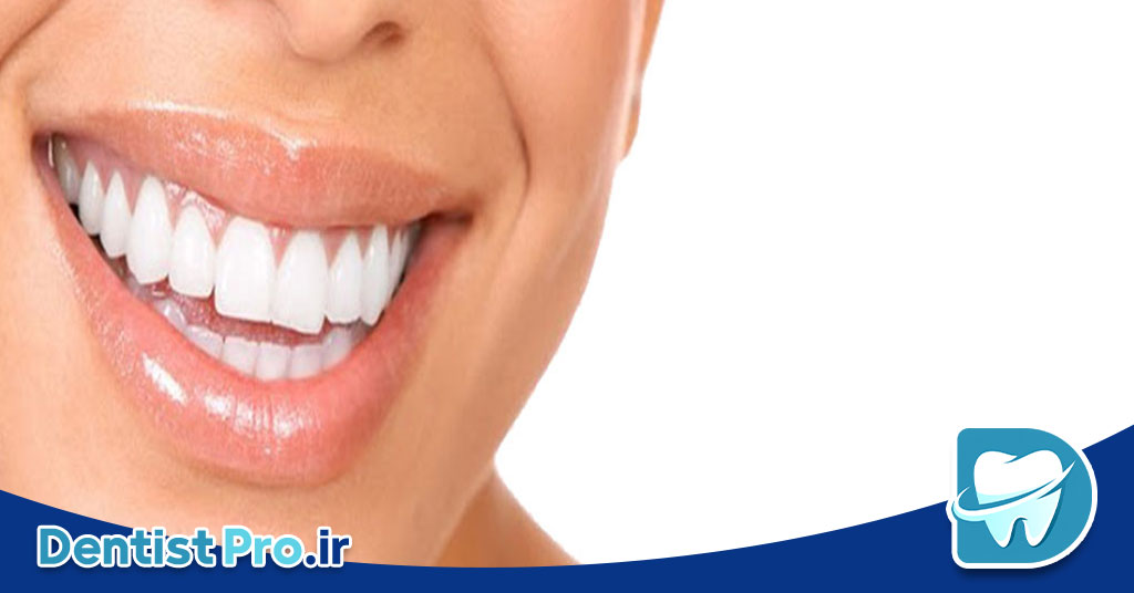 جراحی افزایش طول تاج برای زیبایی لبخند لثه ای 26 جراحی افزایش طول تاج برای زیبایی لبخند لثه ای