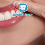 درمان قطعی بوی بد دهان ناشی از لثه