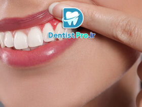 درمان قطعی بوی بد دهان ناشی از لثه