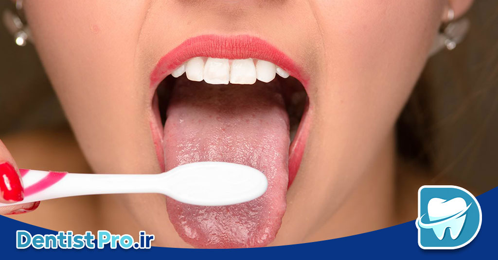 درمان قطعی بوی بد دهان ناشی از لثه