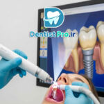 ایمپلنت دیجیتال با اسکن سه بعدی
