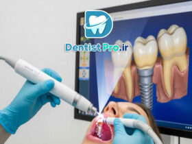 ایمپلنت دیجیتال با اسکن سه بعدی