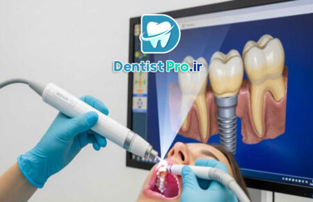 ایمپلنت دیجیتال با اسکن سه بعدی