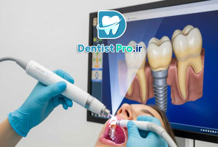 ایمپلنت دیجیتال با اسکن سه بعدی 34 ایمپلنت دیجیتال با اسکن سه بعدی