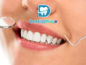 روش انتخاب بهترین فرم دندان در طراحی لبخند