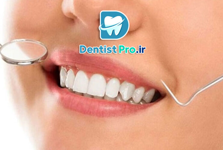 روش انتخاب بهترین فرم دندان در طراحی لبخند