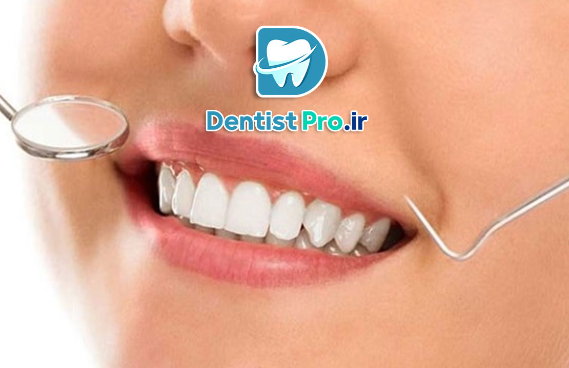 روش انتخاب بهترین فرم دندان در طراحی لبخند