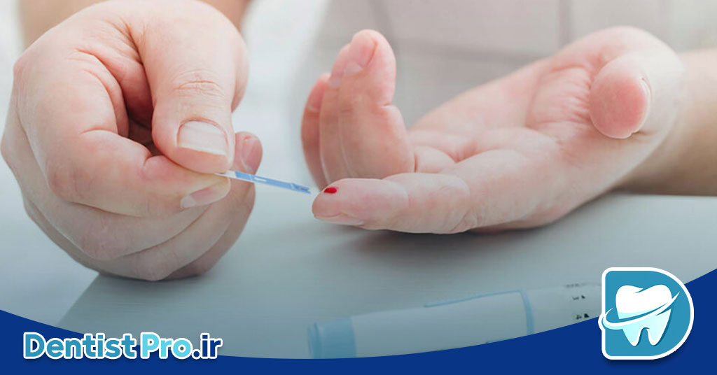 ایمپلنت مناسب بیماران دیابتی کنترل شده