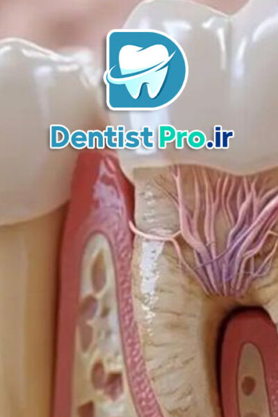 عصب کشی با بی حسی قوی برای اضطراب