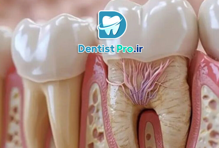 عصب کشی با بی حسی قوی برای اضطراب