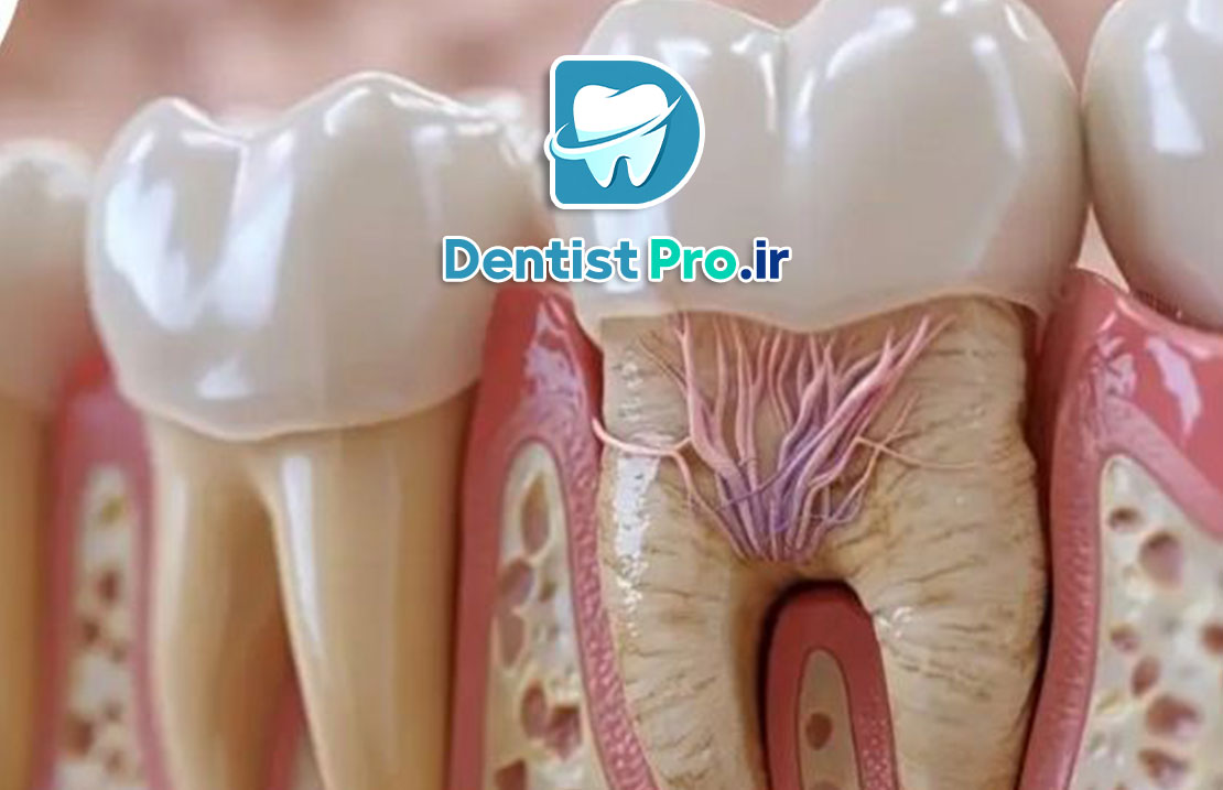 عصب کشی با بی حسی قوی برای اضطراب