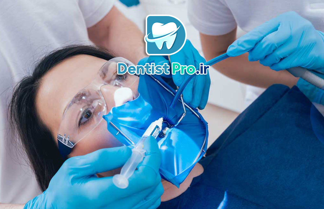 عصب کشی یک جلسه ای برای دندان عفونی: راهنمای جامع و کاربردی