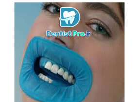 عصب کشی مجدد دندان ترمیم شده