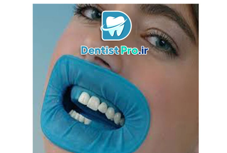 عصب کشی مجدد دندان ترمیم شده