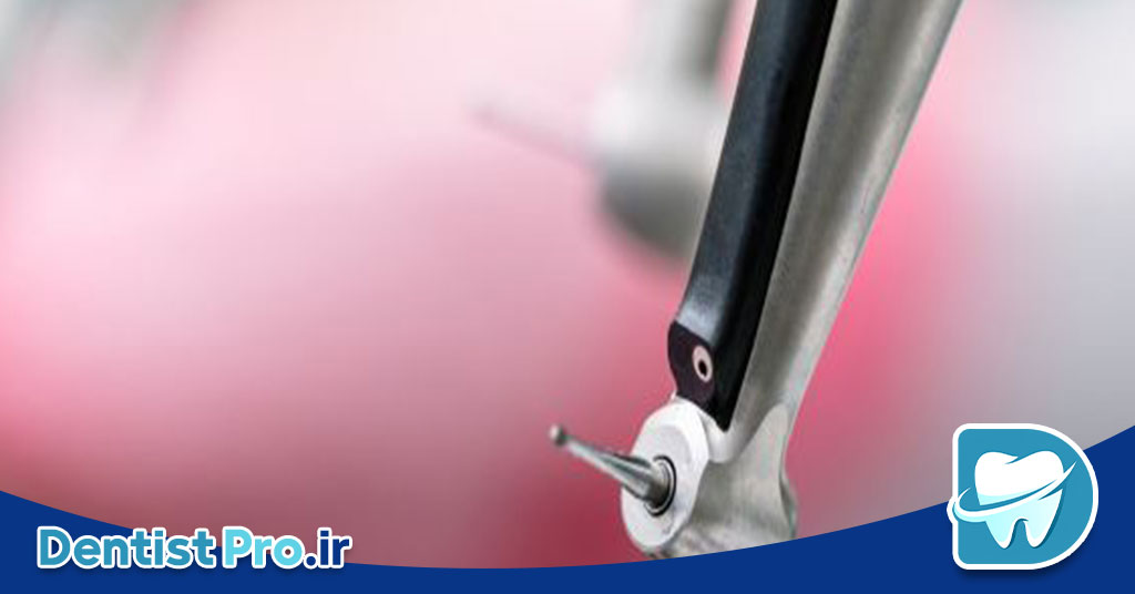 عصب کشی تخصصی دندان مولر با دستگاه روتاری؛ راهنمای کامل و تخصصی 26 عصب کشی تخصصی دندان مولر با دستگاه روتاری