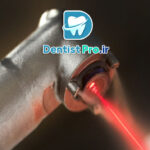 عصب کشی تخصصی دندان مولر با دستگاه روتاری