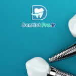 بررسی 0 تا 100 ایمپلنت سوئیسی با گارانتی