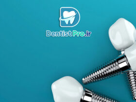 بررسی 0 تا 100 ایمپلنت سوئیسی با گارانتی