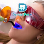 پر کردن دندان با کامپوزیت نانو مقاوم