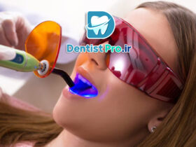 پر کردن دندان با کامپوزیت نانو مقاوم