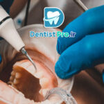 درمان تحلیل لثه با جراحی بازسازی بافت