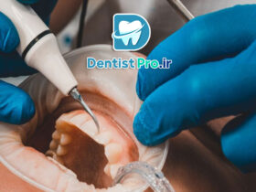 درمان تحلیل لثه با جراحی بازسازی بافت