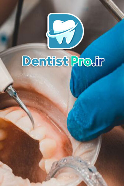 درمان تحلیل لثه با جراحی بازسازی بافت