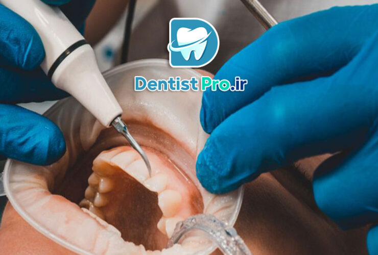 درمان تحلیل لثه با جراحی بازسازی بافت 39 درمان تحلیل لثه با جراحی بازسازی بافت