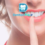 بهترین دکتر کامپوزیت برای لبخند طبیعی