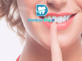 بهترین دکتر کامپوزیت برای لبخند طبیعی
