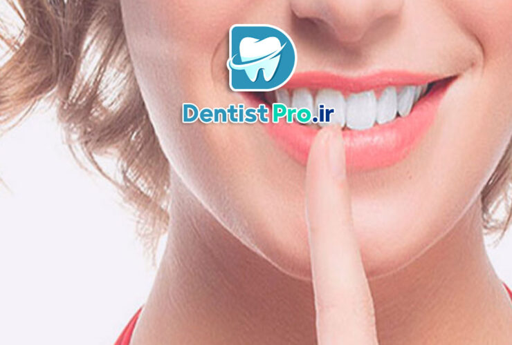 بهترین دکتر کامپوزیت برای لبخند طبیعی