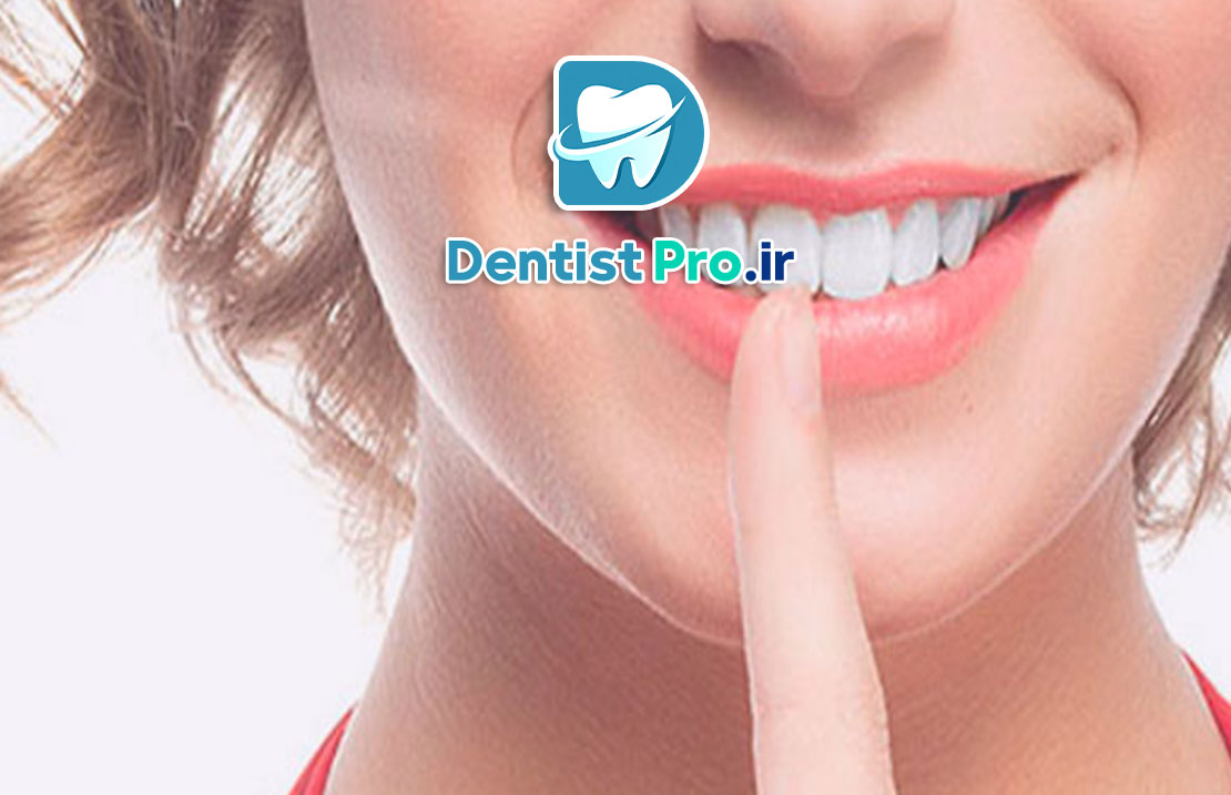 بهترین دکتر کامپوزیت برای لبخند طبیعی