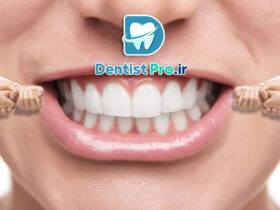 بهترین روش ارتودنسی سریع برای بزرگسالان شاغل