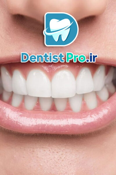 بهترین روش ارتودنسی سریع برای بزرگسالان شاغل