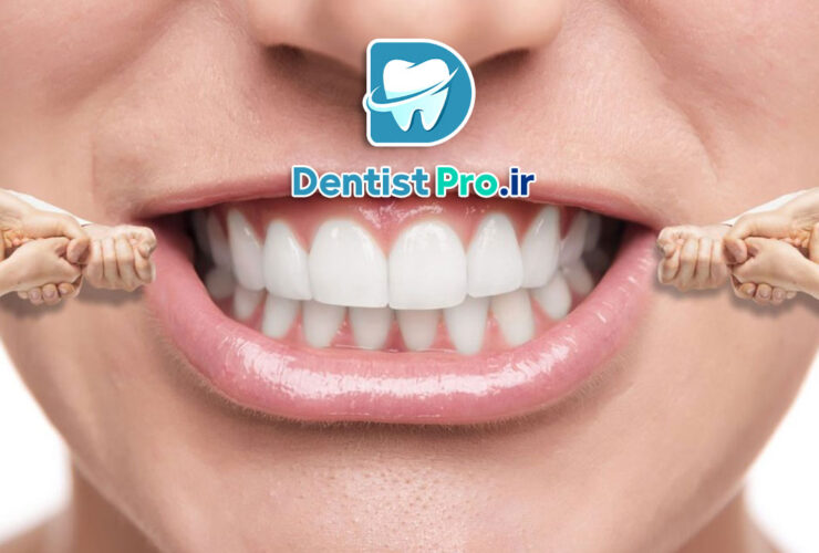 بهترین روش ارتودنسی سریع برای بزرگسالان شاغل