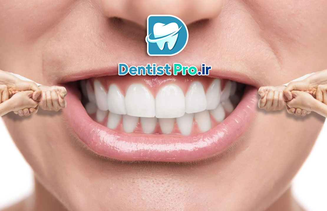 بهترین روش ارتودنسی سریع برای بزرگسالان شاغل