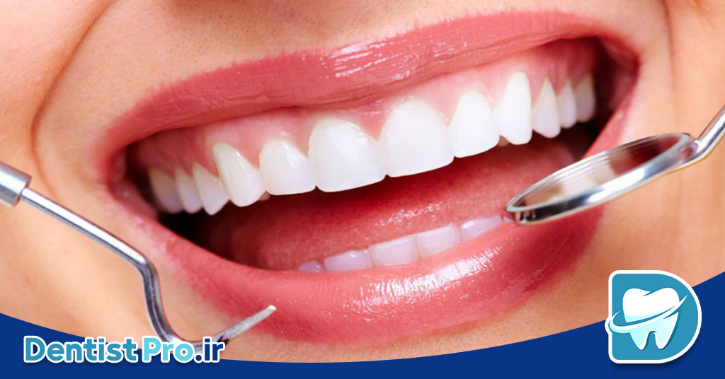 بهترین روش جرم گیری بدون آسیب مینای دندان