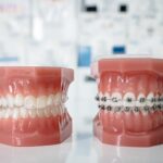 بررسی شرایط اقساطی و هزینه ارتودنسی در کلینیک‌های شرق تهران