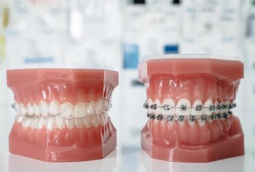 بررسی شرایط اقساطی و هزینه ارتودنسی در کلینیک‌های شرق تهران