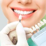 لمینت متحرک دندان چیست؟ مزایا و معایب آن