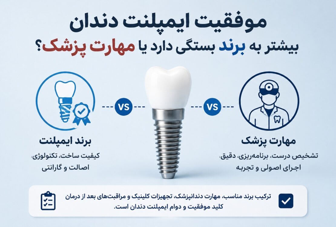 موفقیت ایمپلنت دندان بیش‌تر به برند بستگی دارد یا مهارت پزشکی؟